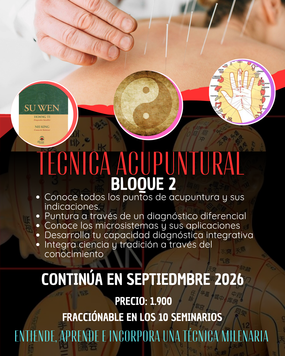 Póster que ilustra diversas técnicas acupunturales, utilizado como material didáctico en el centro de formación HARA para la enseñanza de la Medicina Tradicional China. 2º curso