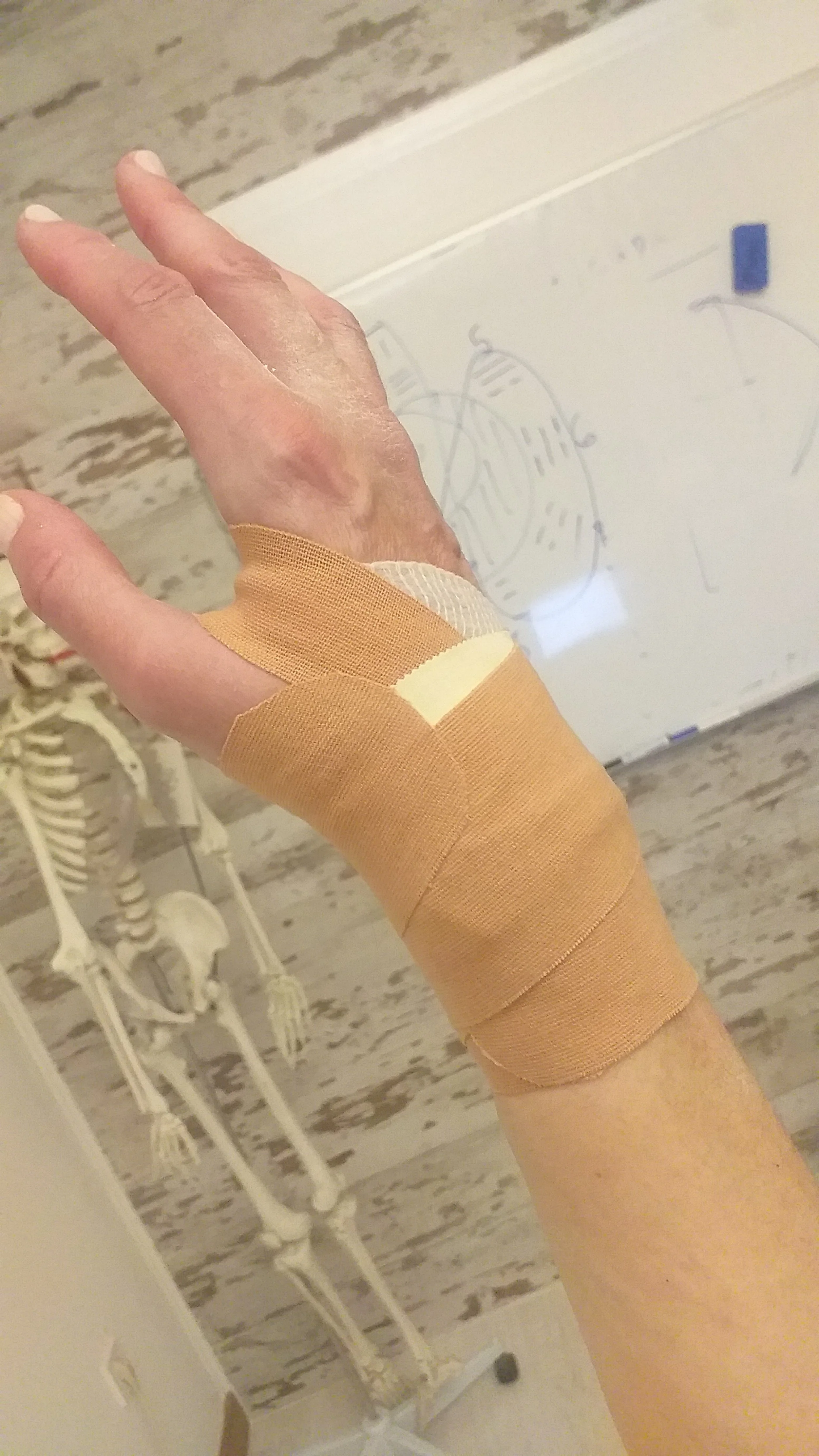 Vendaje de muñeca para tratar una luxación, realizado durante el curso de Osteopatía Estructural en HARA Formación en Madrid.