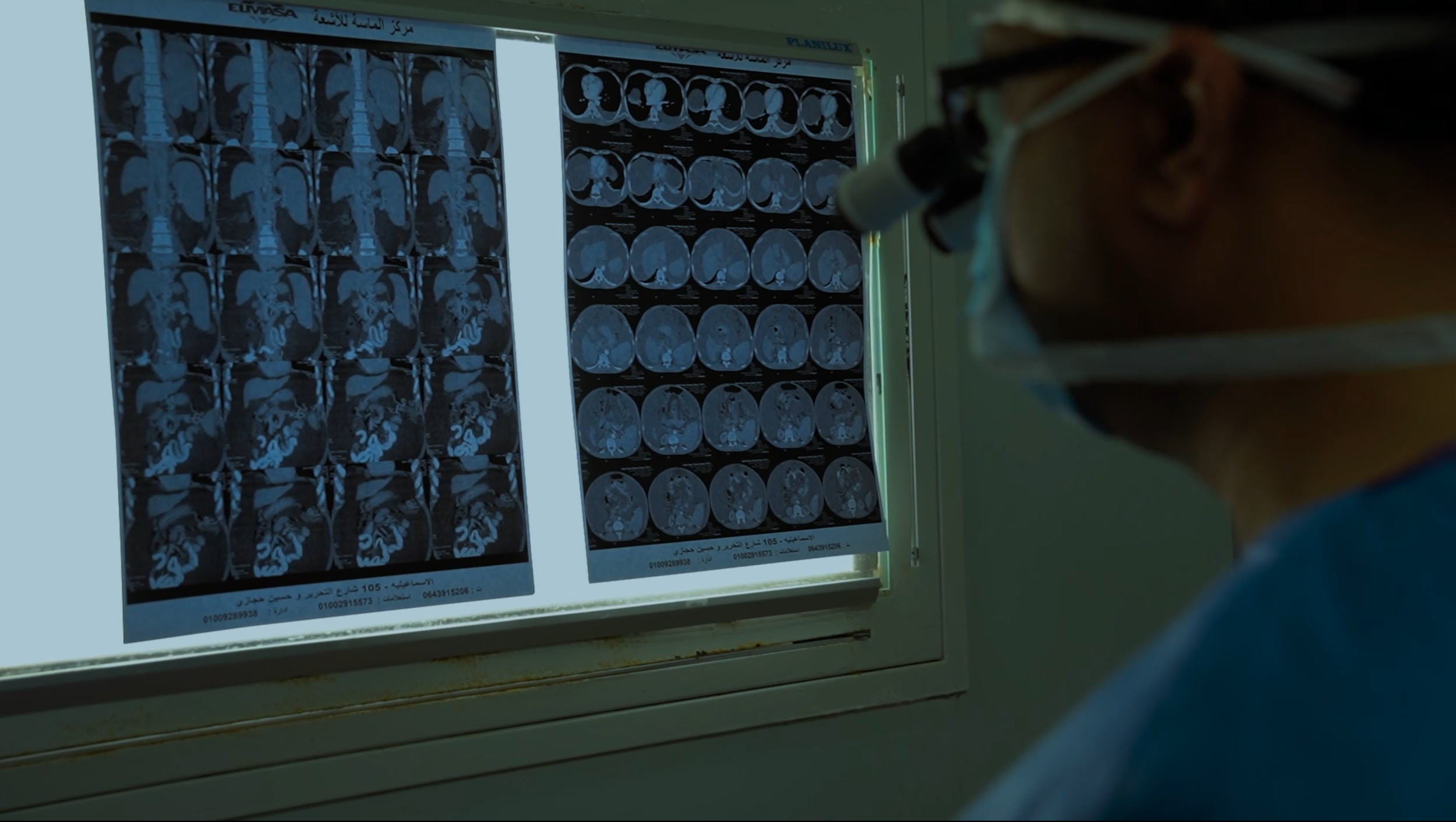 Transplant Preparation.png