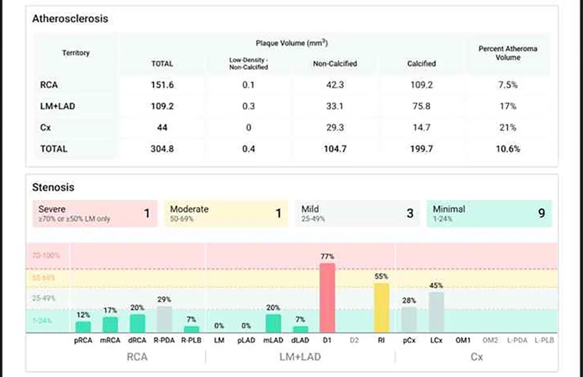 Baseline Cleerly Report
Total plaque burden · Jan 2024