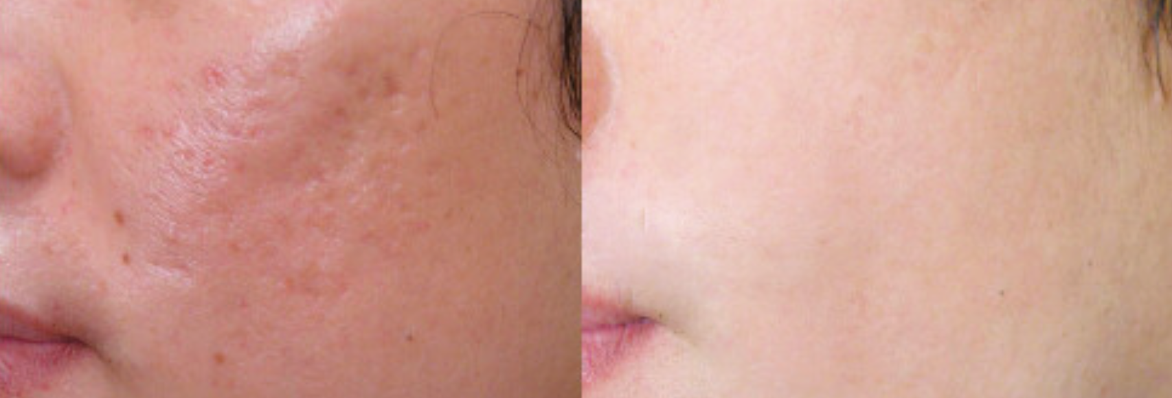 Screenshot 2024-02-29 at 4.37.57 PM.png