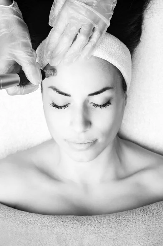 microneedling with prp2.jpg