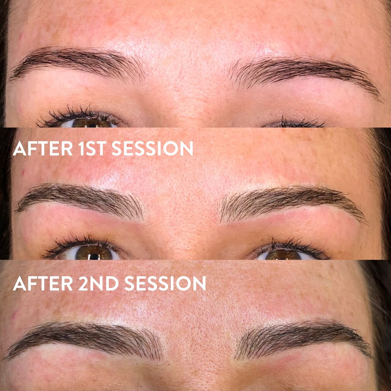 Brows after 1st and 2nd session of microblading.

Can you see the seamlessly blended hair strokes as if they were her own existing brows?

Brows by Annaliese.

Book your free consult for SPMU (Semi-Permanent Makeup) treatments. 

Remember to book bef