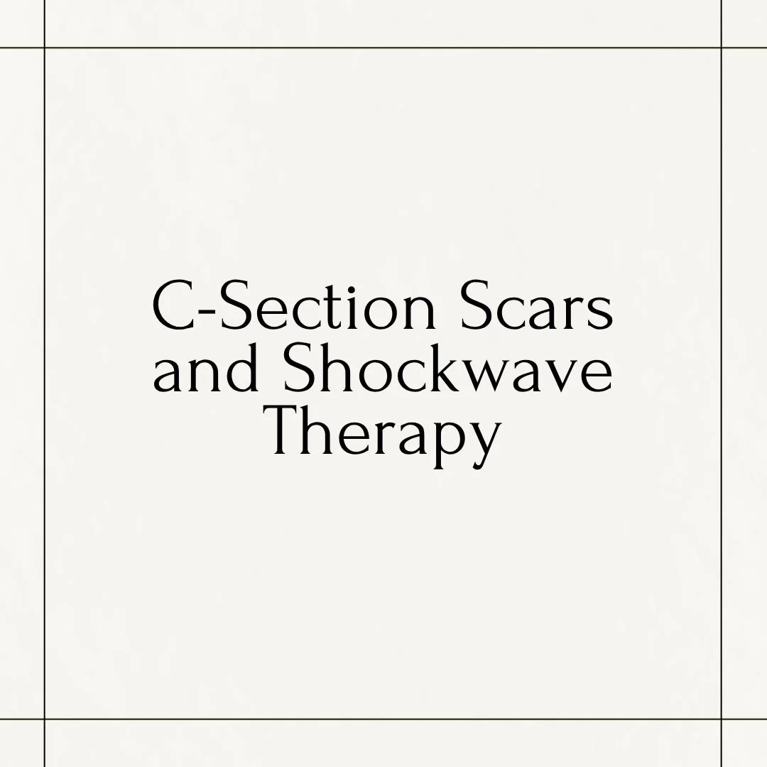 C-Section Scars and Shockwave Therapy