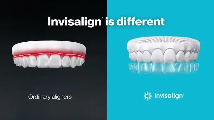 Invisalign vs Other Clear Aligners: What’s the Real Difference?