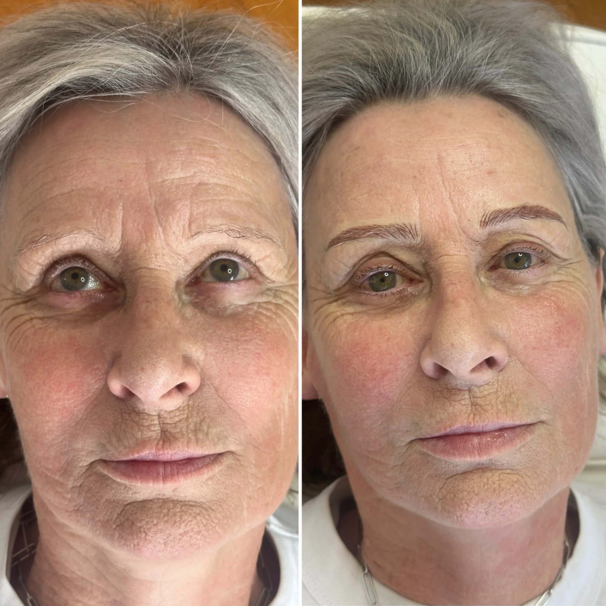 Real clients, real skin, no filter.

Let's talk about expectations:
Photos of young, plump, collagen rich skin can be misleading to mature females.
- Older skin can be more prone to bleeding. Think more immediate redness and reactions.
- Brow hairs o