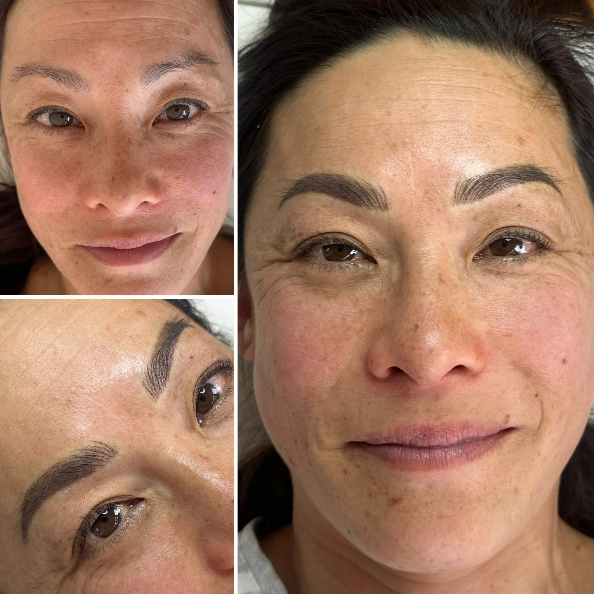 Before and after close-up images of a woman's face showing the results of a combination cosmetic eyebrow procedure.