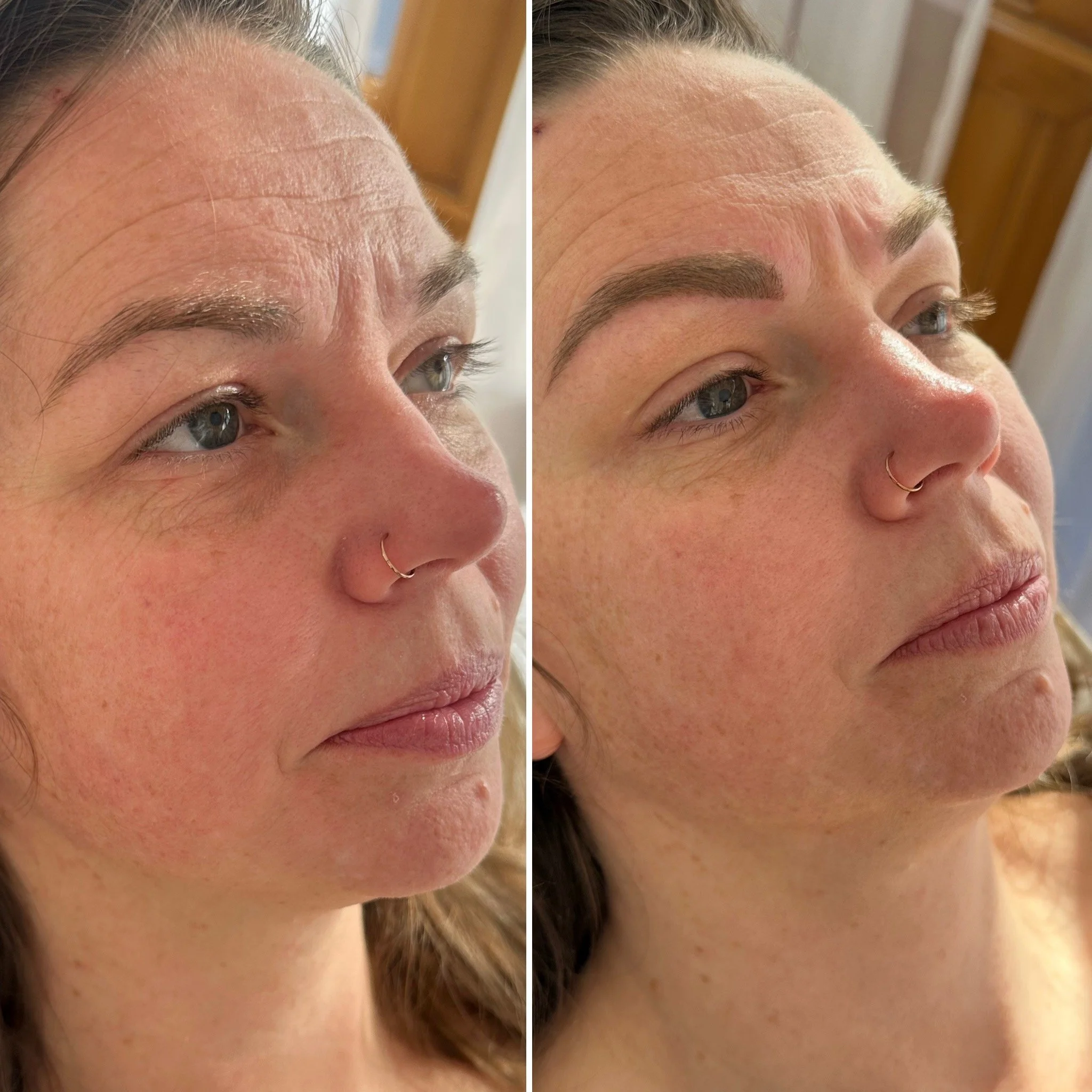 Side-by-side comparison of a woman's face before and after eyebrow ombre brow tattoo, showing fuller, more defined eyebrows in the after photo.