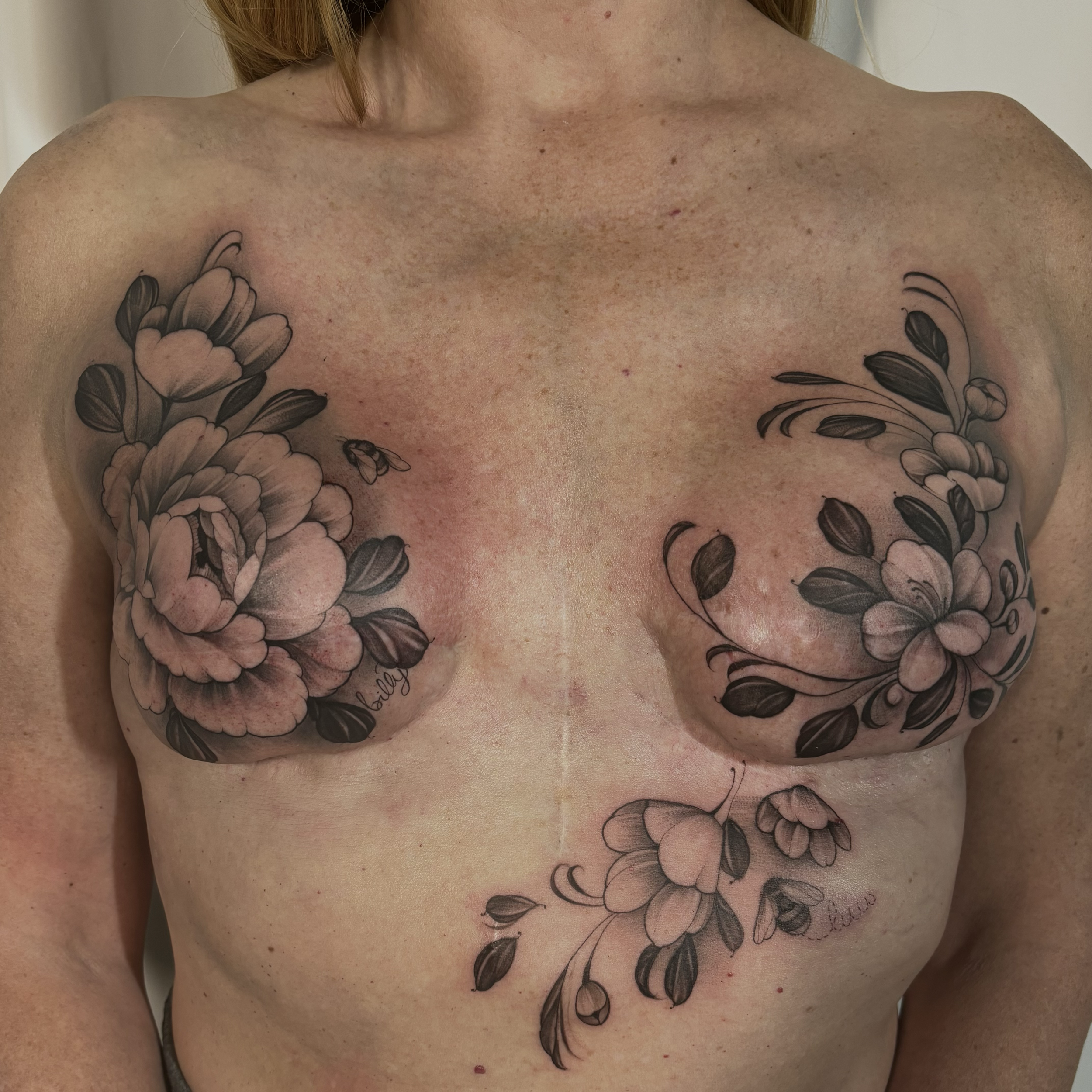 After Double Mastectomy Scar Cover up
