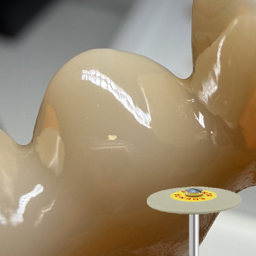 Emergence profile polish Fine