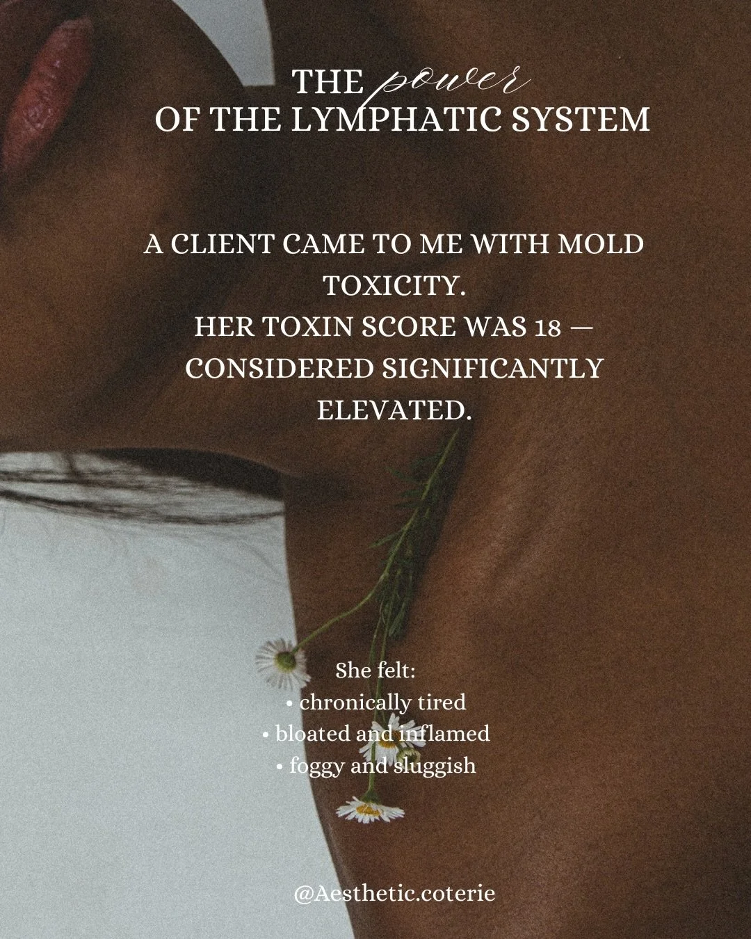 Mold exposure is more common than people realize &mdash; and the symptoms often show up as fatigue, brain fog, bloating, inflammation, and feeling &ldquo;off&rdquo; without clear answers.

One of my clients came in with a mold toxin score of 18, whic