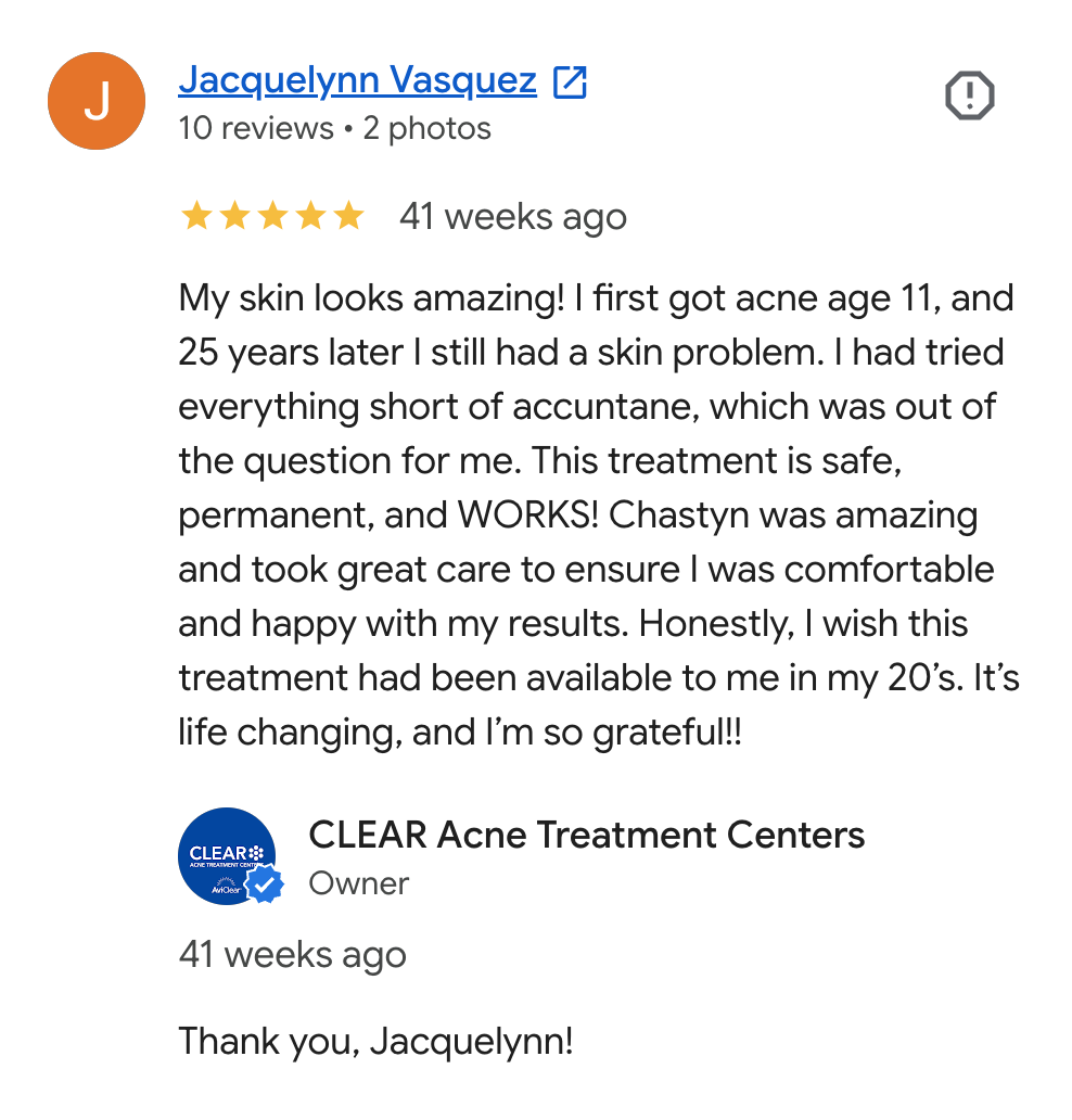 Screenshot of an online review from Jacquelynn Vasquez praising CLEAR Acne Treatment Centers, describing her skin improvement after treatment, and expressing her gratitude.