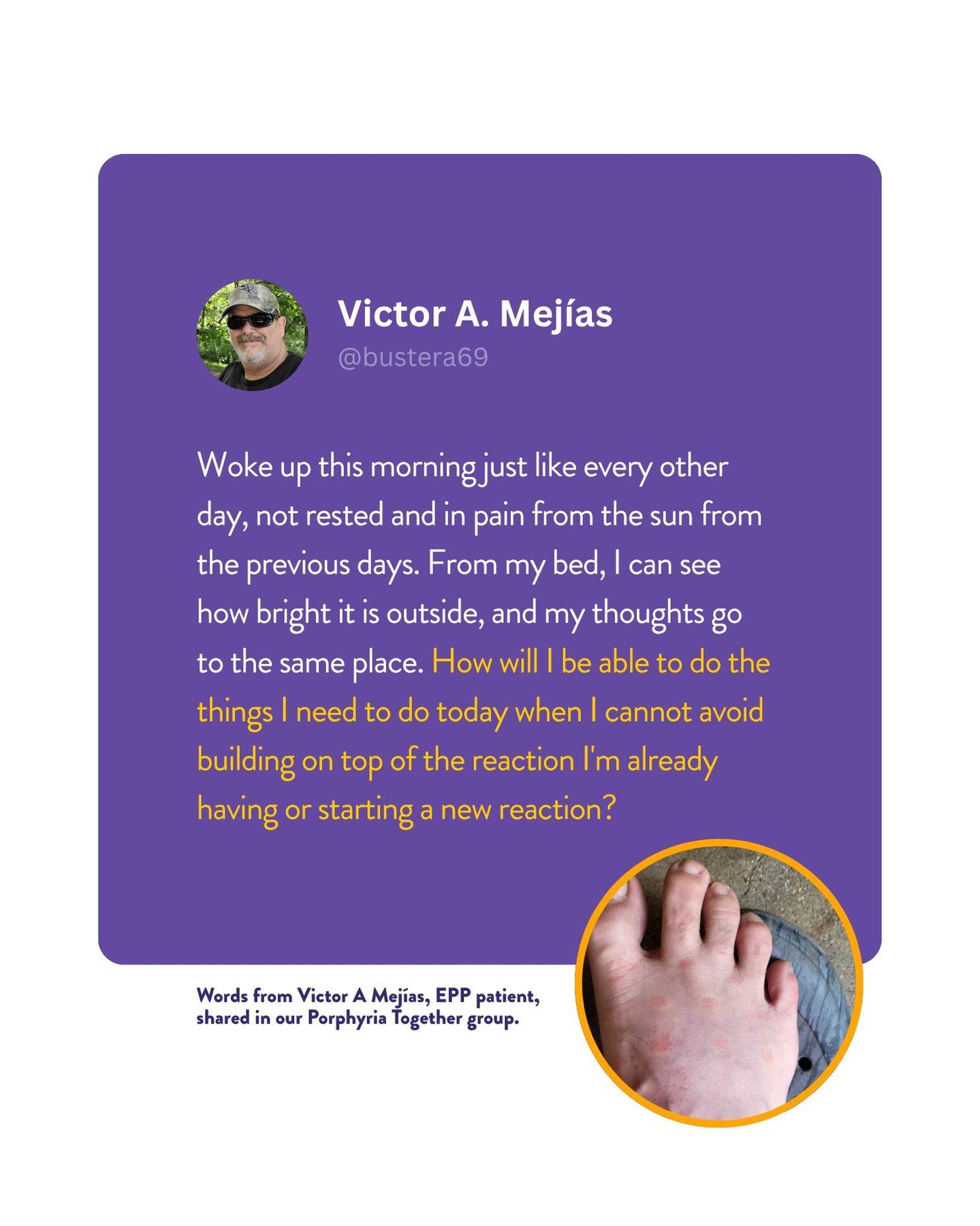 Words from Victor A Mej&iacute;as, EPP patient and mentor, shared in our Porphyria Together group:
&quot;Woke up this morning just like every other day, not rested and in pain from the sun from the previous days. From my bed, I can see how bright it 