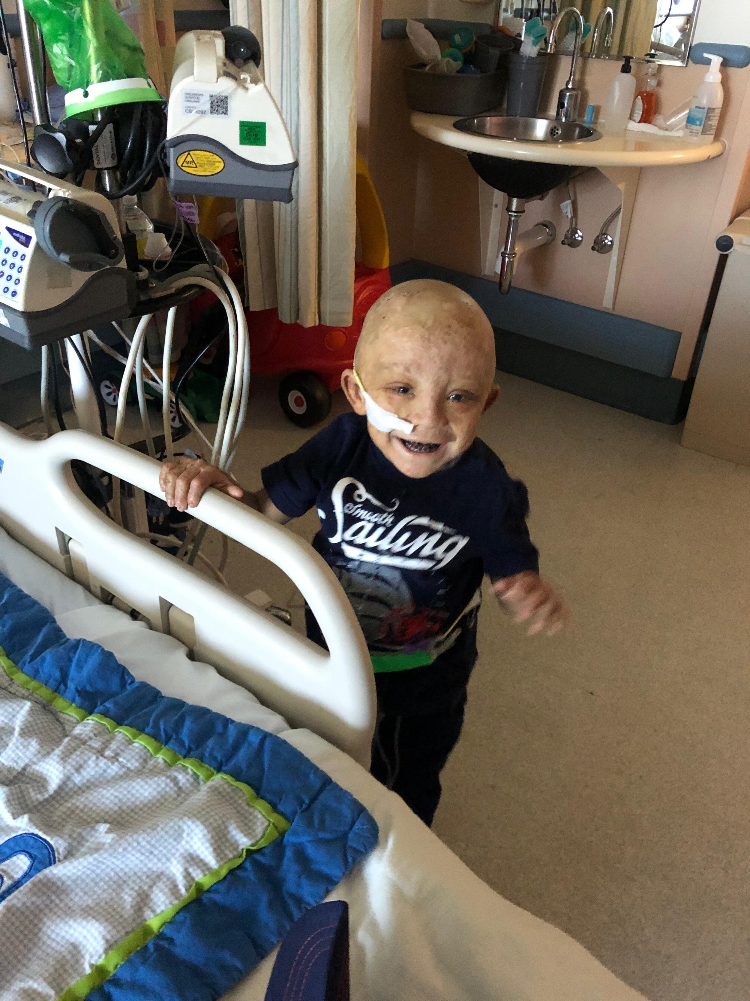 congenital erythropoietic porphyria