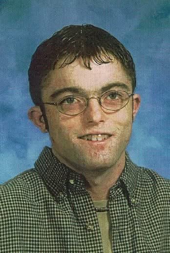 congenital erythropoietic porphyria