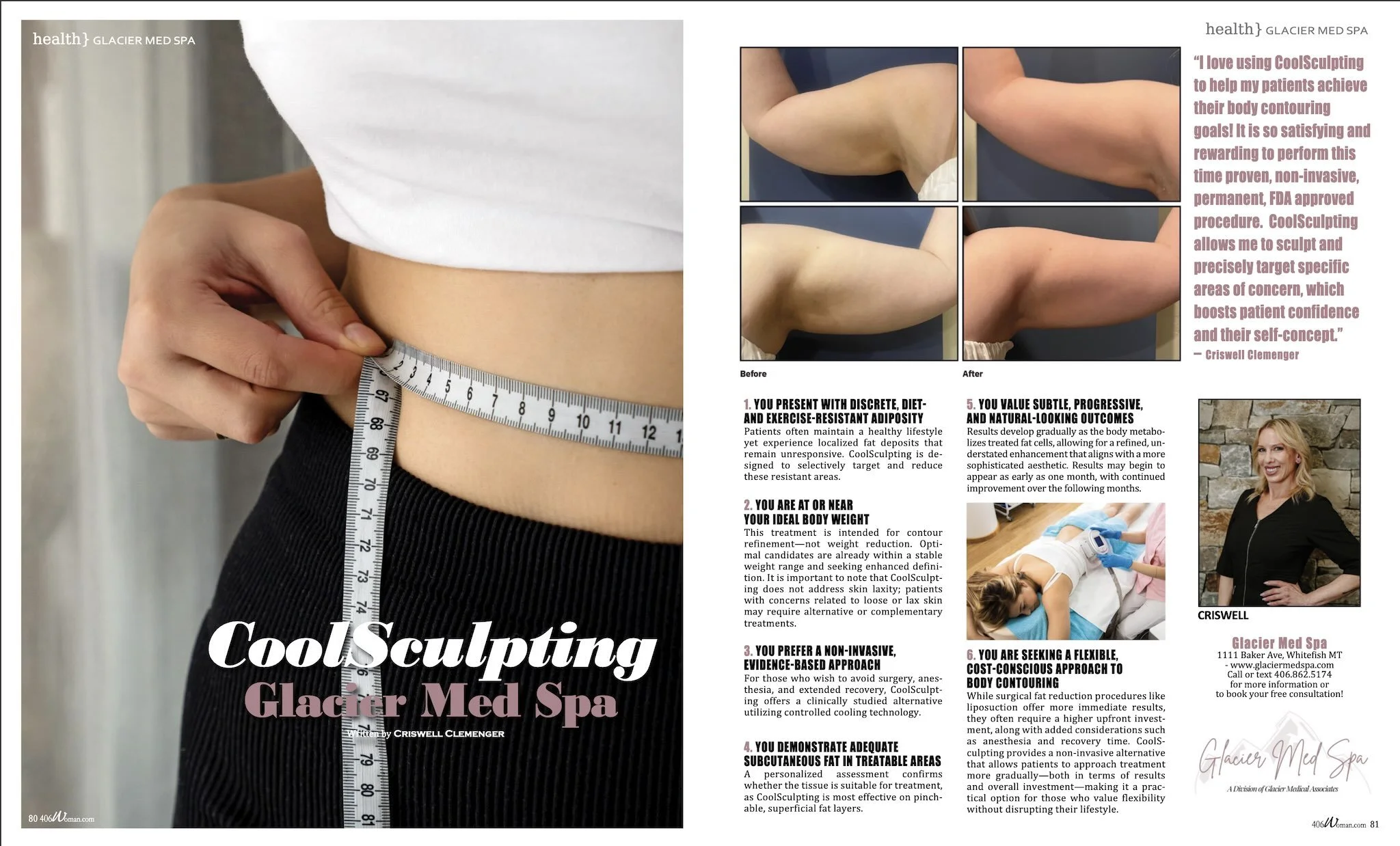 Coolsculpting