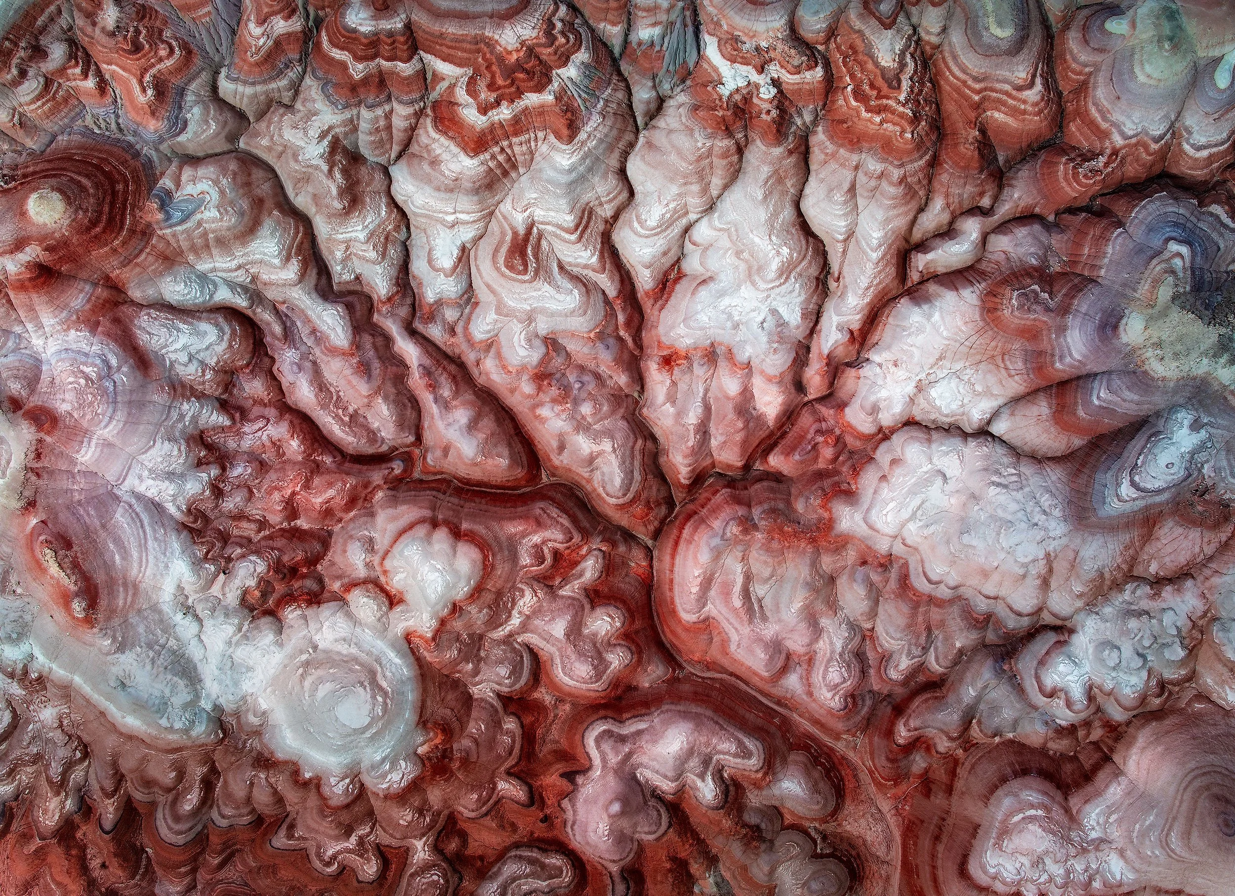 Cerebral