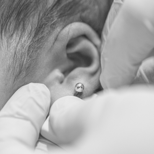 Imagem de uma bebe tendo a orelha furada