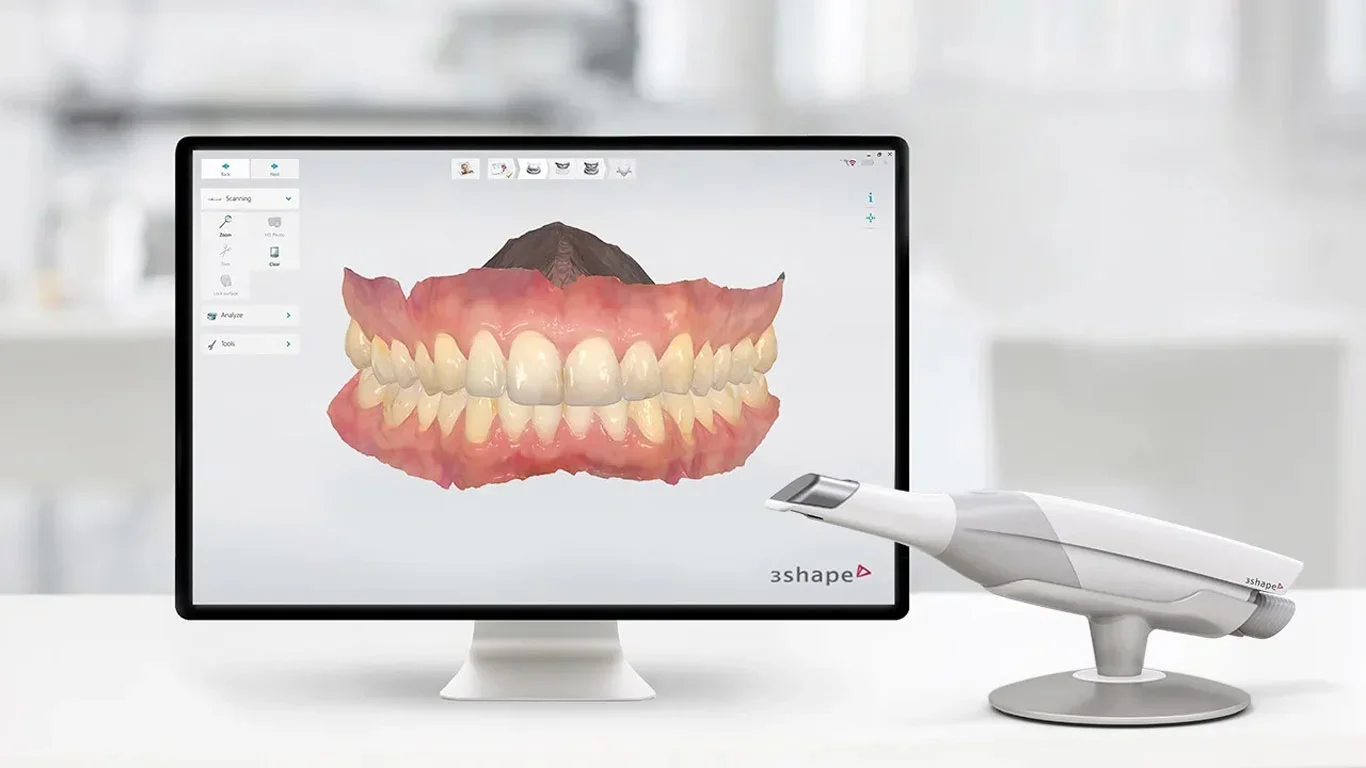Paradigm Shift in Dental Impressions
