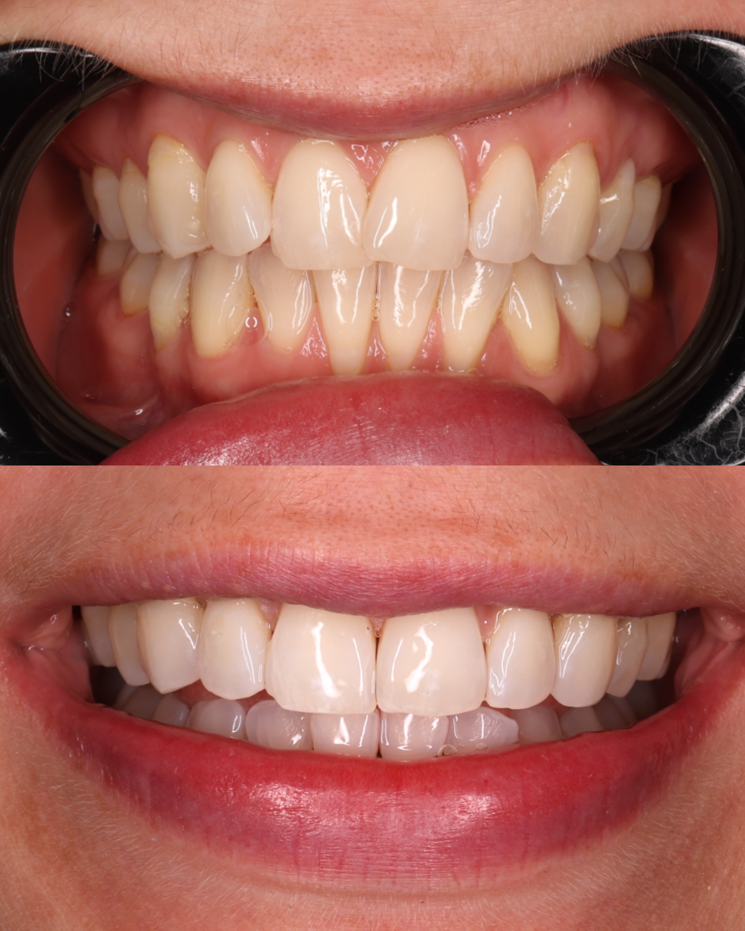 Copy of Untitled Design.png