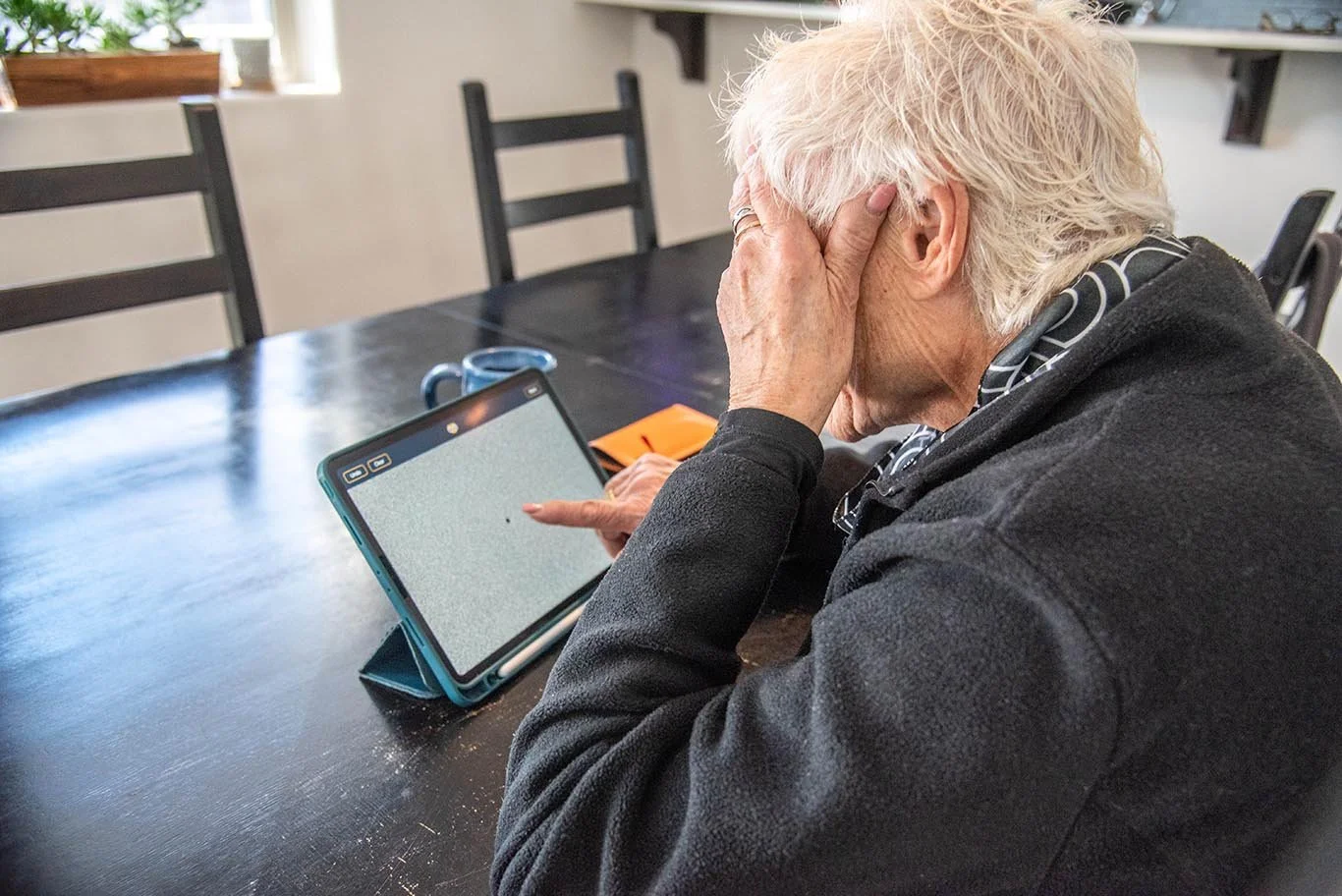 The Importance of Monitoring Dry Macular Degeneration