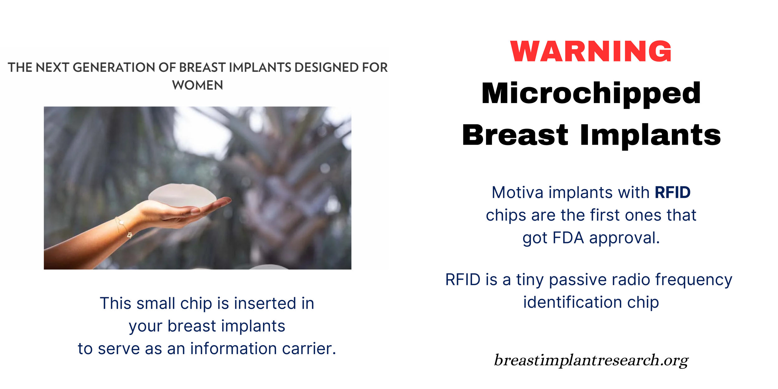 Microchipped Breast Implant