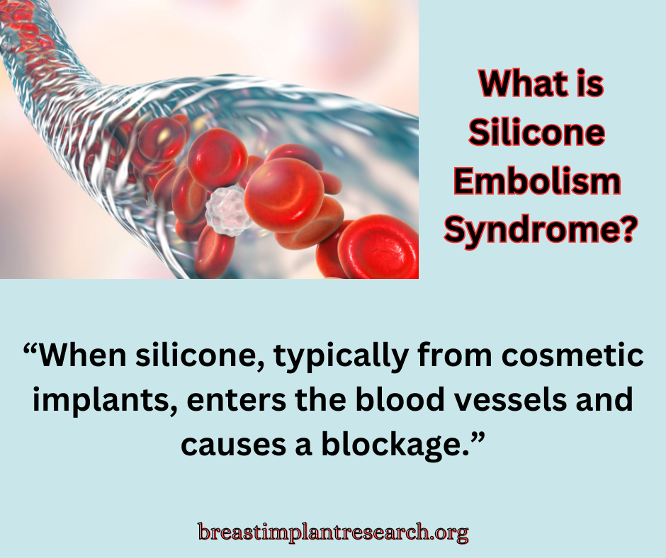 Silicone Embolism Syndrome