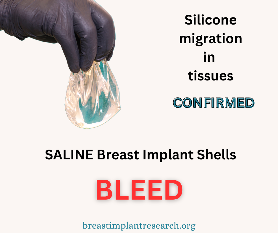 Saline Bleed silicone migration