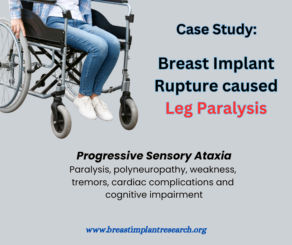 Leg Paralysis