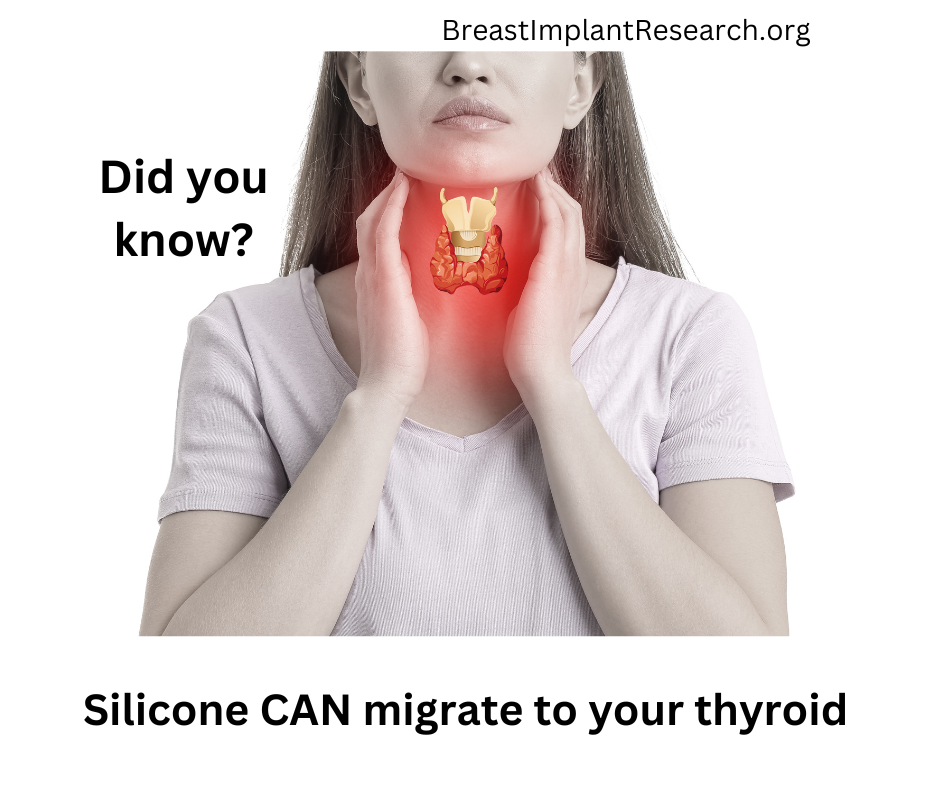 Silicone in thyroid tissue