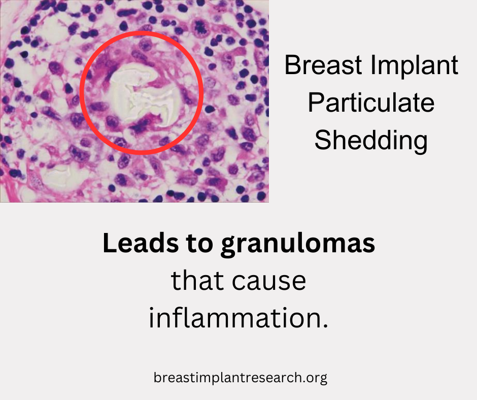 Particulate Shedding