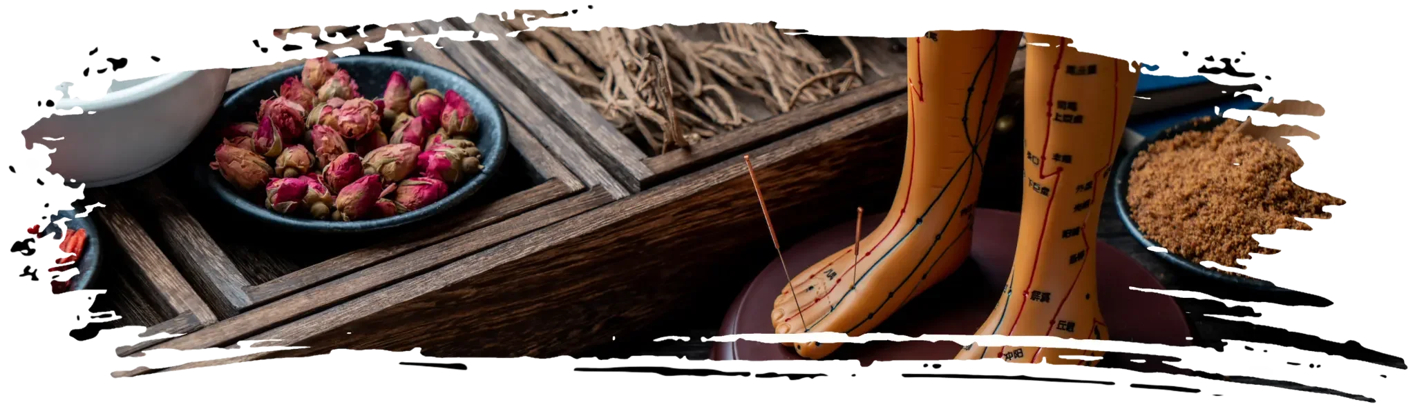 Acupuncture and Chinese phytotherapy