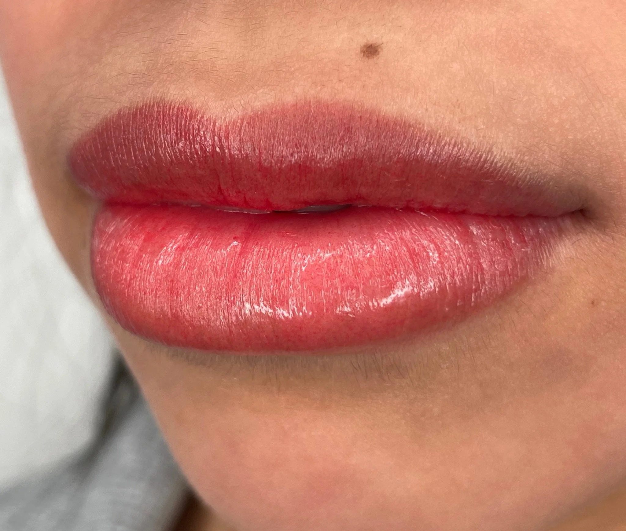 Close-up of lips with glossy pink lipstick and a small mole above the upper lip.