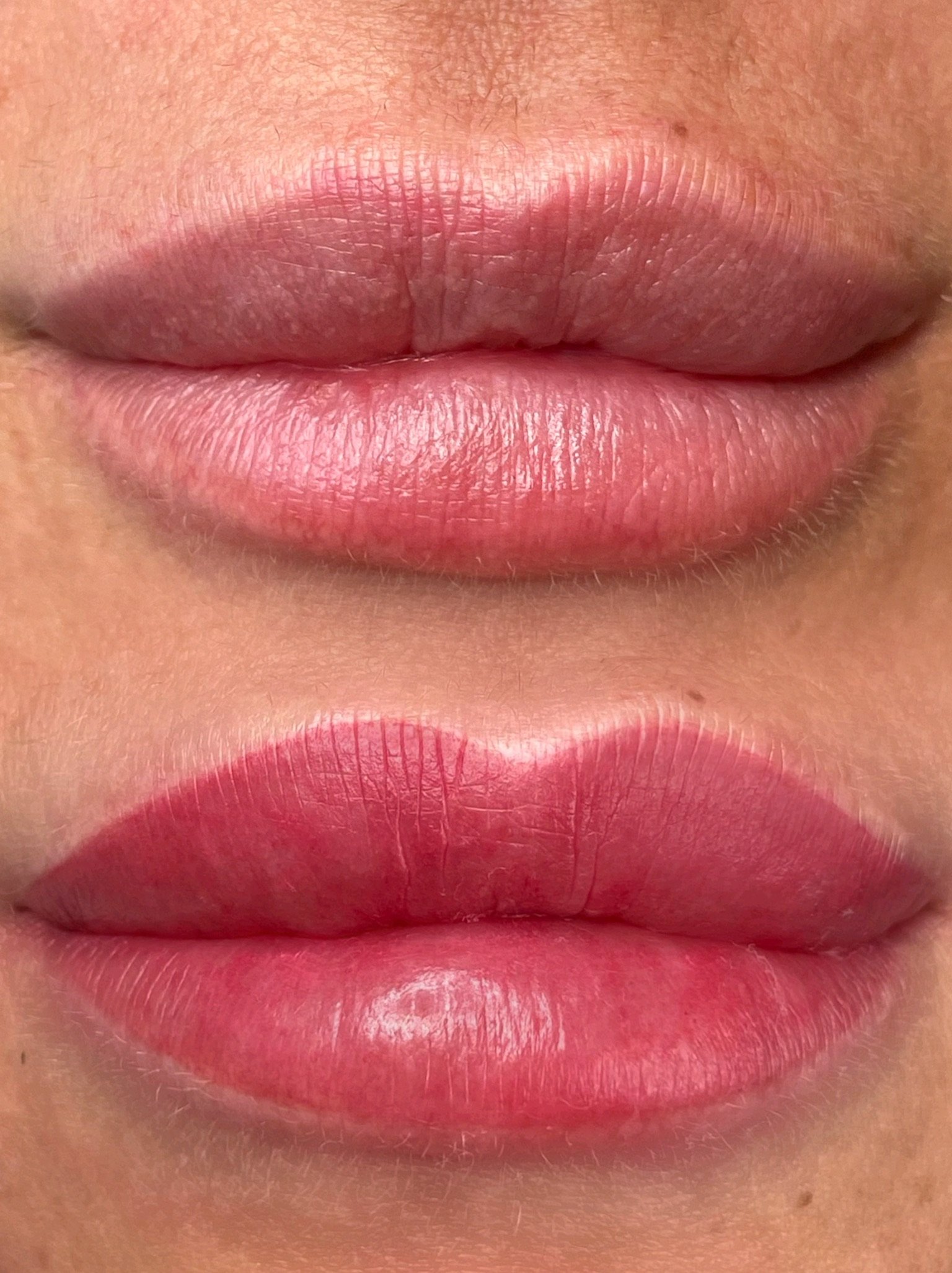 Before and after image of lips showing tattoo lip blush treatment, top is natural and bottom is after treatment with enhanced color.