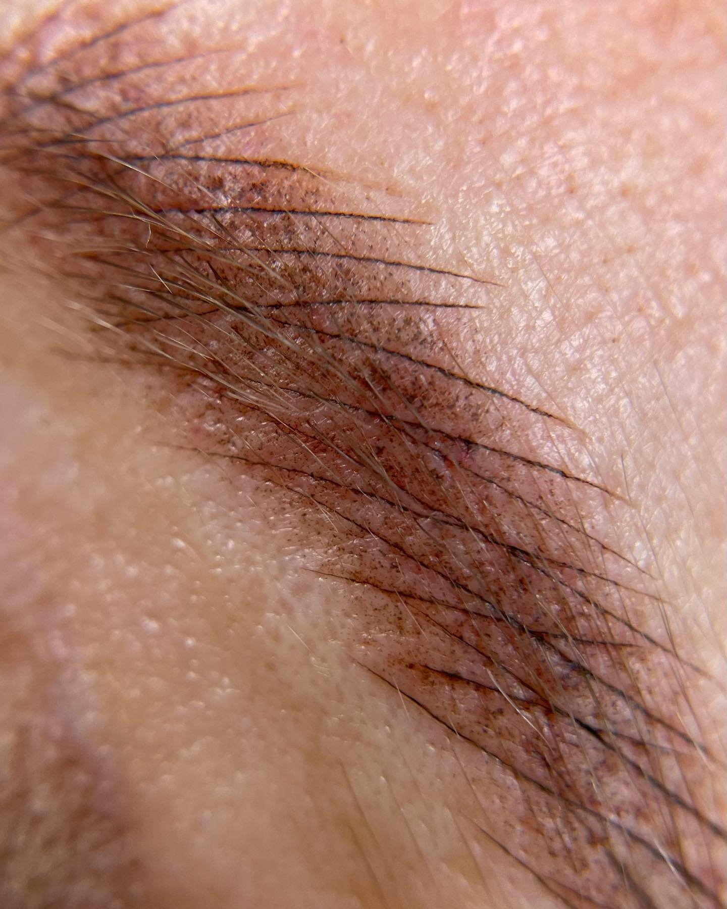 combo-brow-healed.jpg