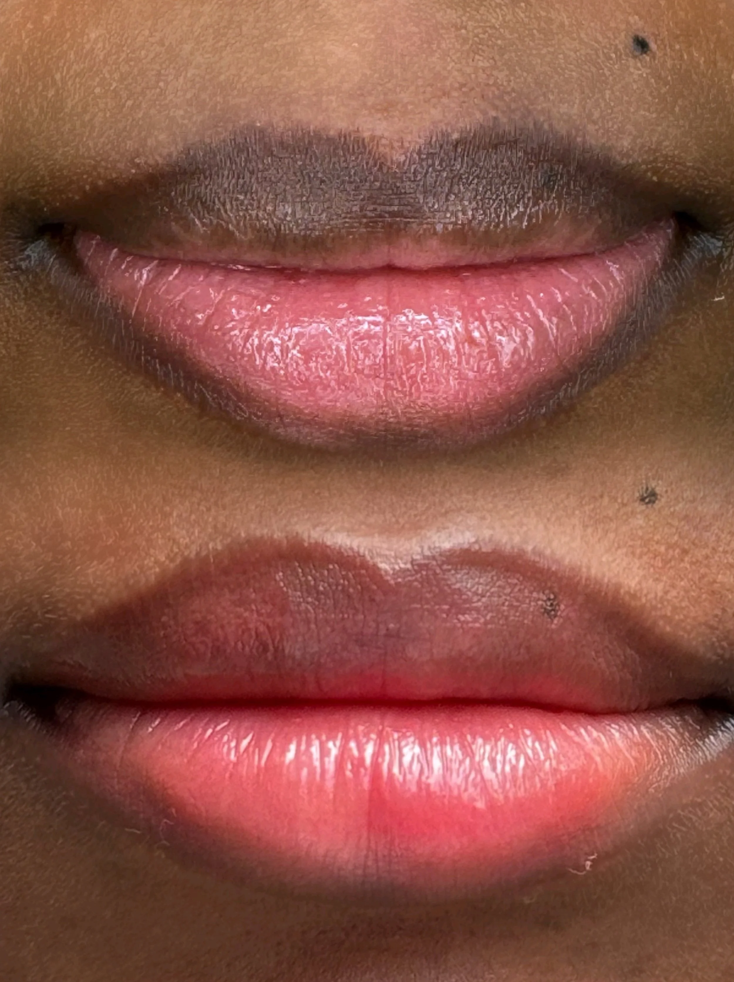 Close-up of a person's lips before and after applying lip balm, showing a change from dry to moisturized lips.