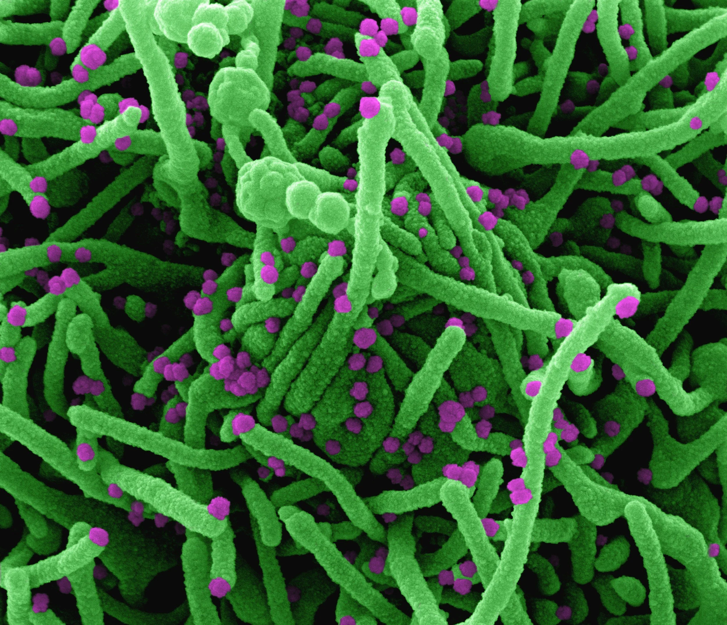Menopause and the Gut Microbiome: The Overlooked Connection That Shapes Your Health