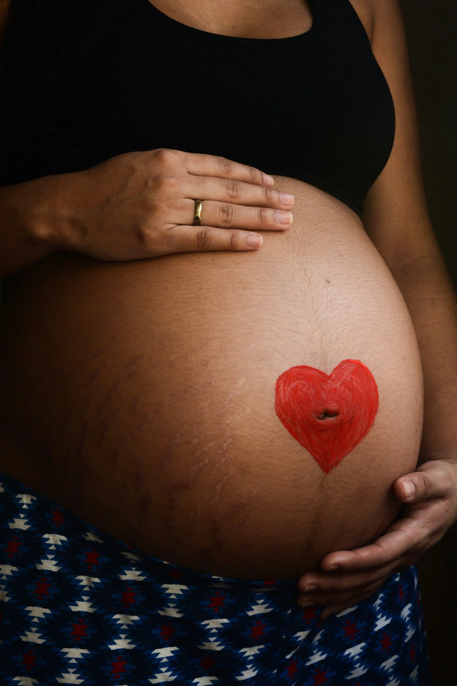 Pregnancy Complications and Future Health: Why Obstetric History Matters Long After Delivery