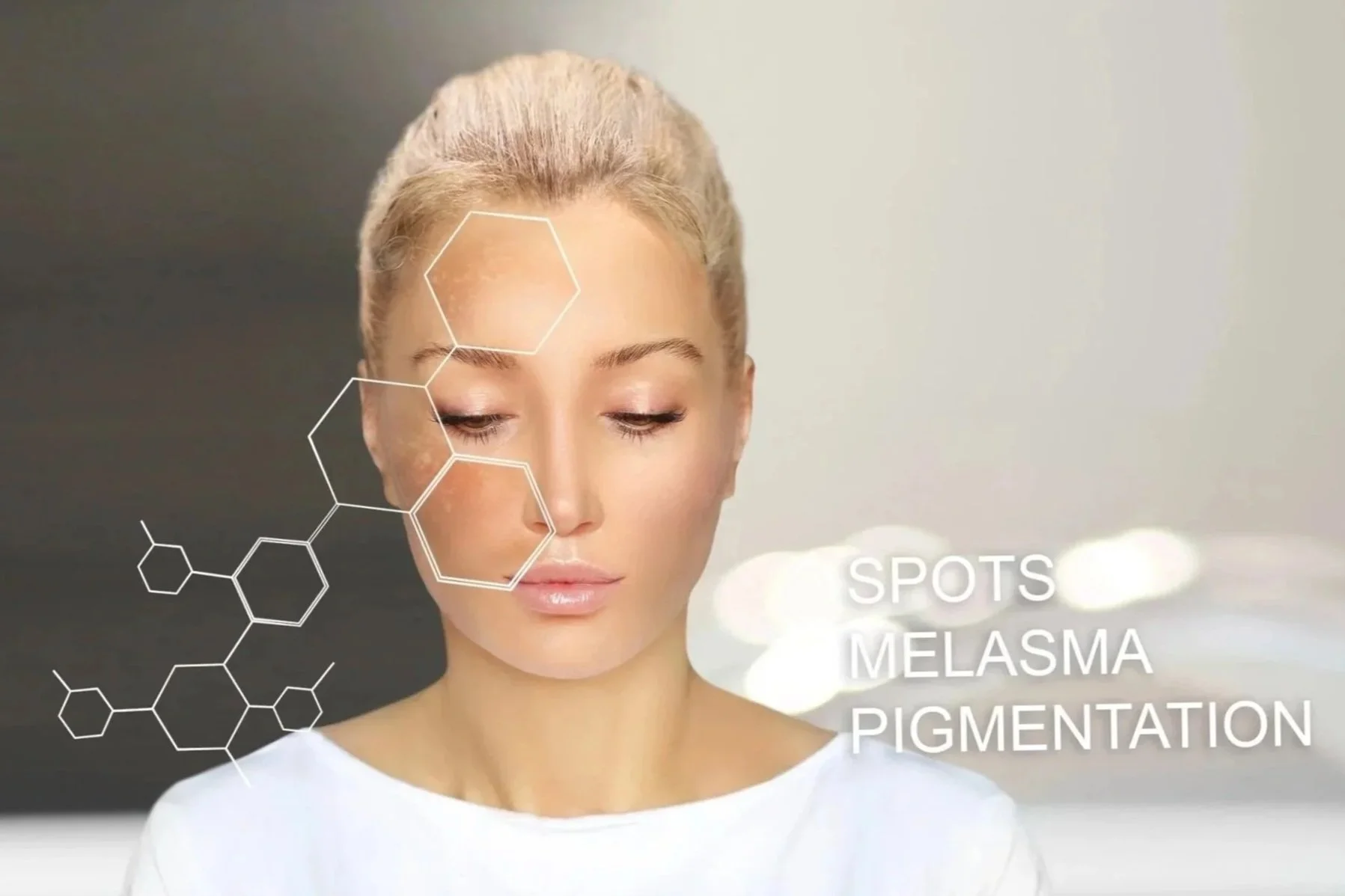 A woman with blond hair and closed eyes looks downward. Over her face, there are white hexagon outlines and the words "SPOTS, MELASMA, PIGMENTATION" written in white text.