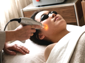 getting laser skin resurfacing with picoway laser