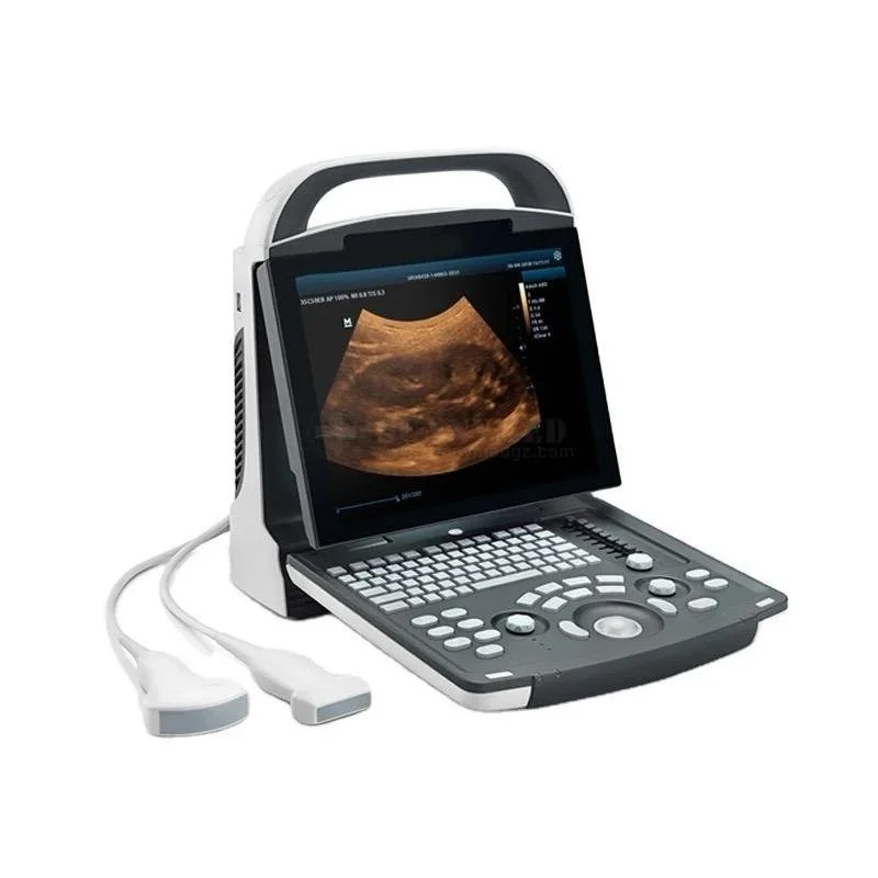 Mindray DP-10 Ultrasonido Portátil