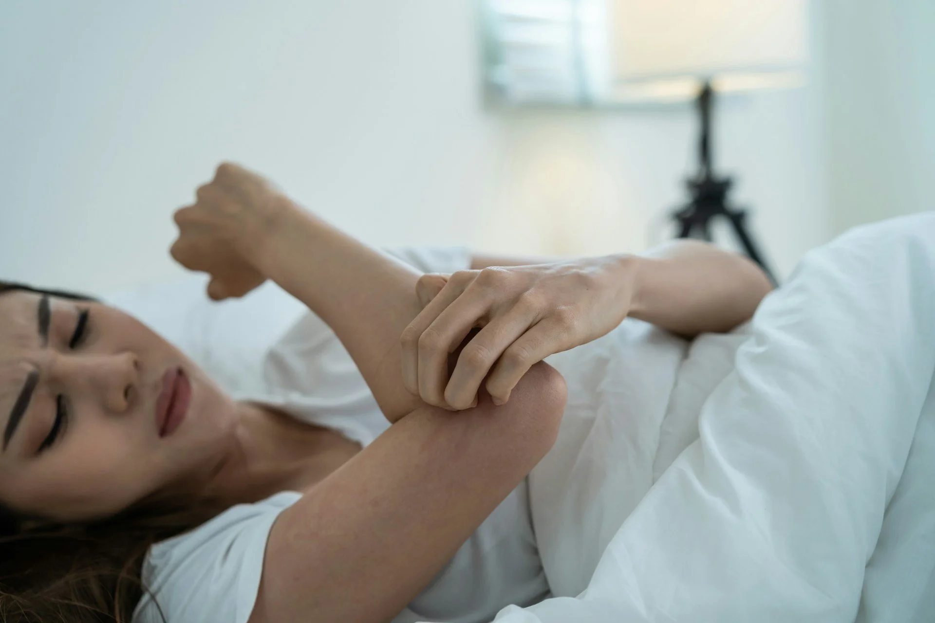 Recognizing Severe Bed Bug Bite Injuries That Justify a Lawsuit