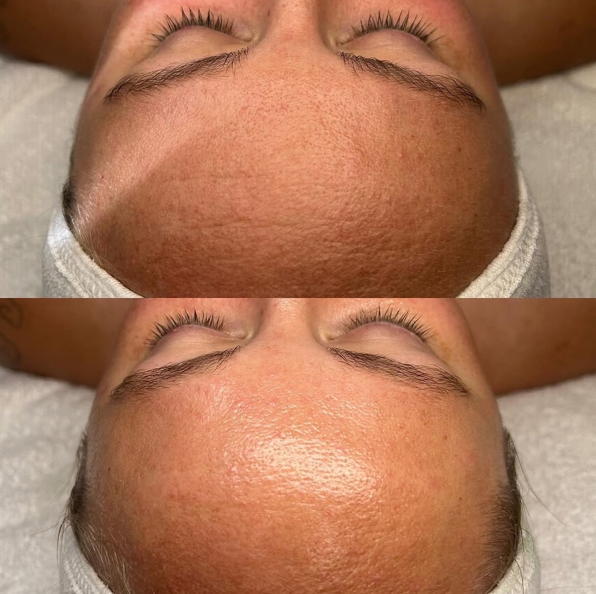 Dull congested skin, you need some maintenance. Book the best facials in Santa Cruz at Ace Esthetics 

We&rsquo;ve curated a team of experienced professionals to make sure what ever service you receive is TOP NOTCH ✨