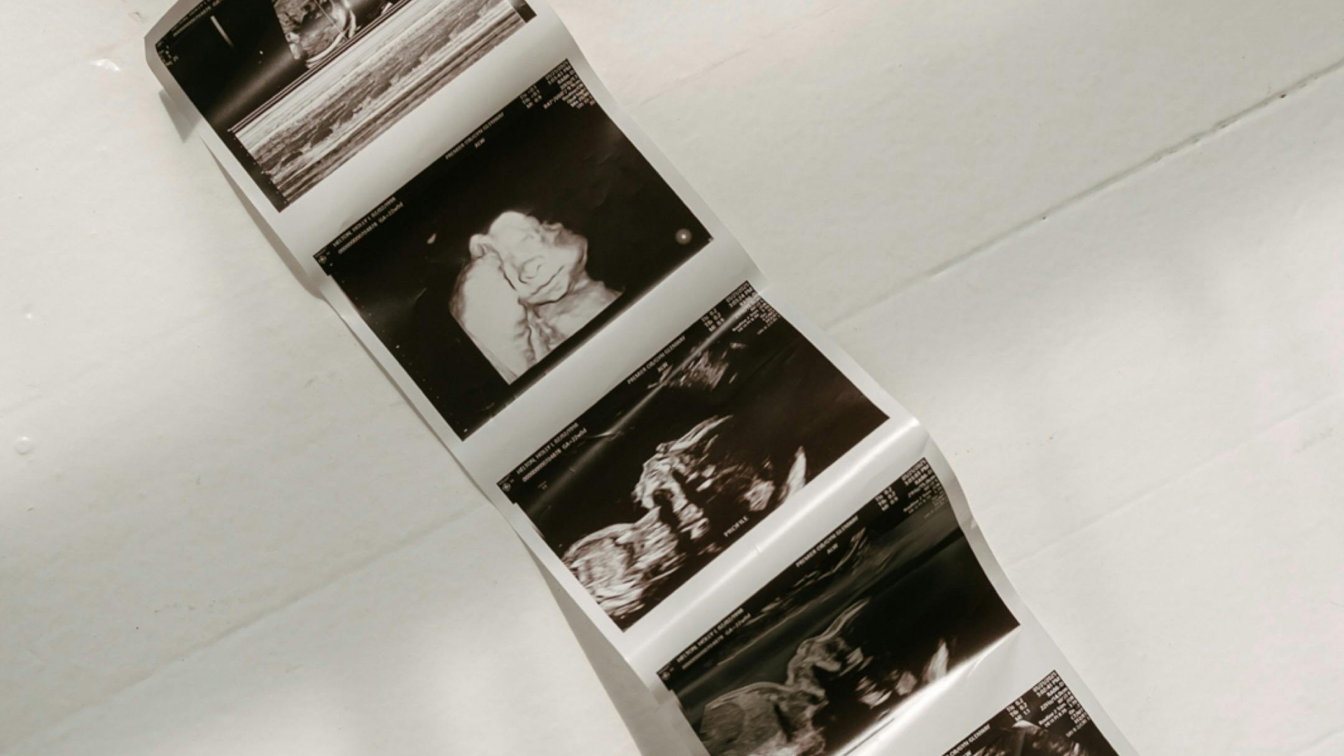A strip of ultrasound images showing a developing fetus, laid out on a white surface.