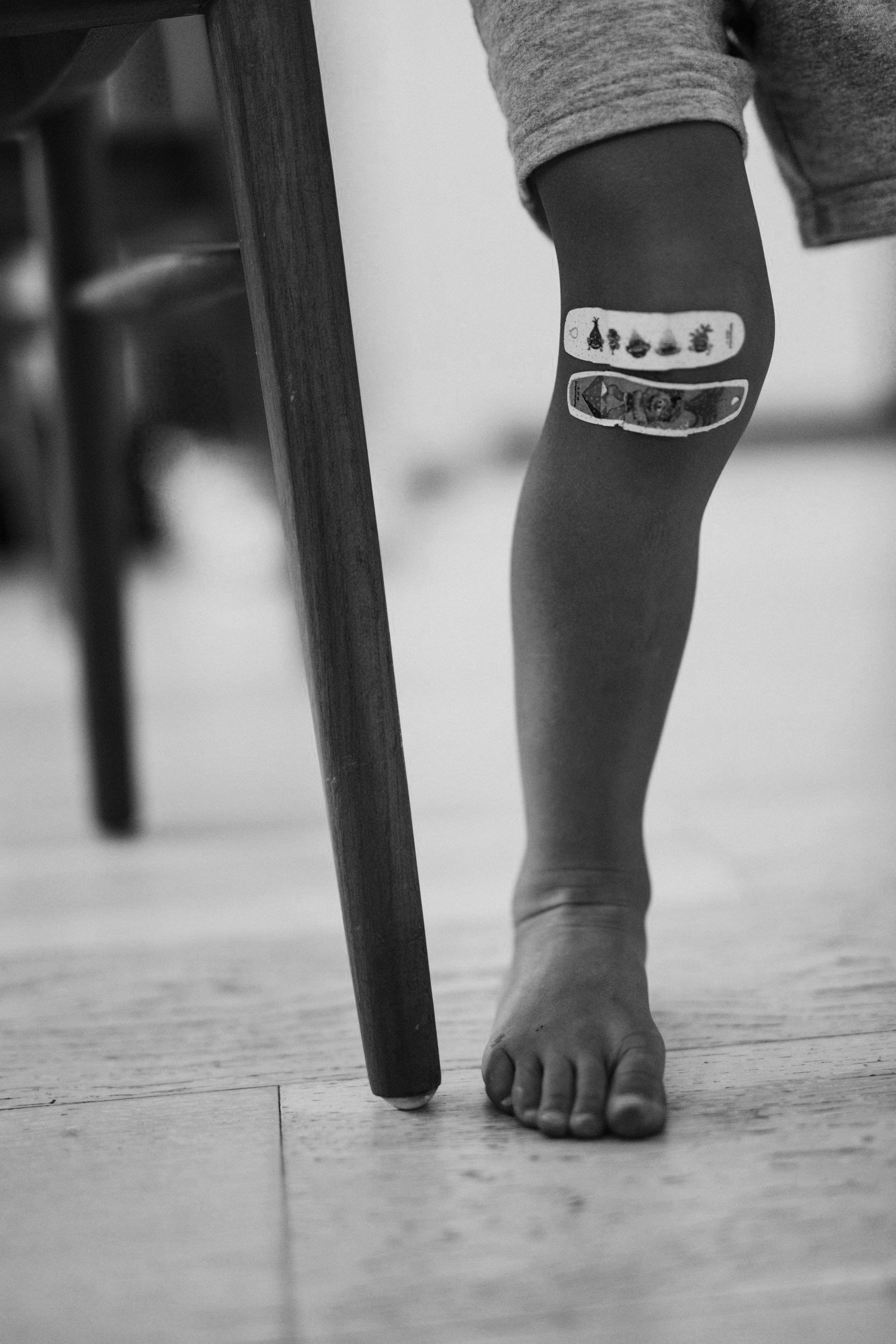 Scraped Knees and Bruised Pride