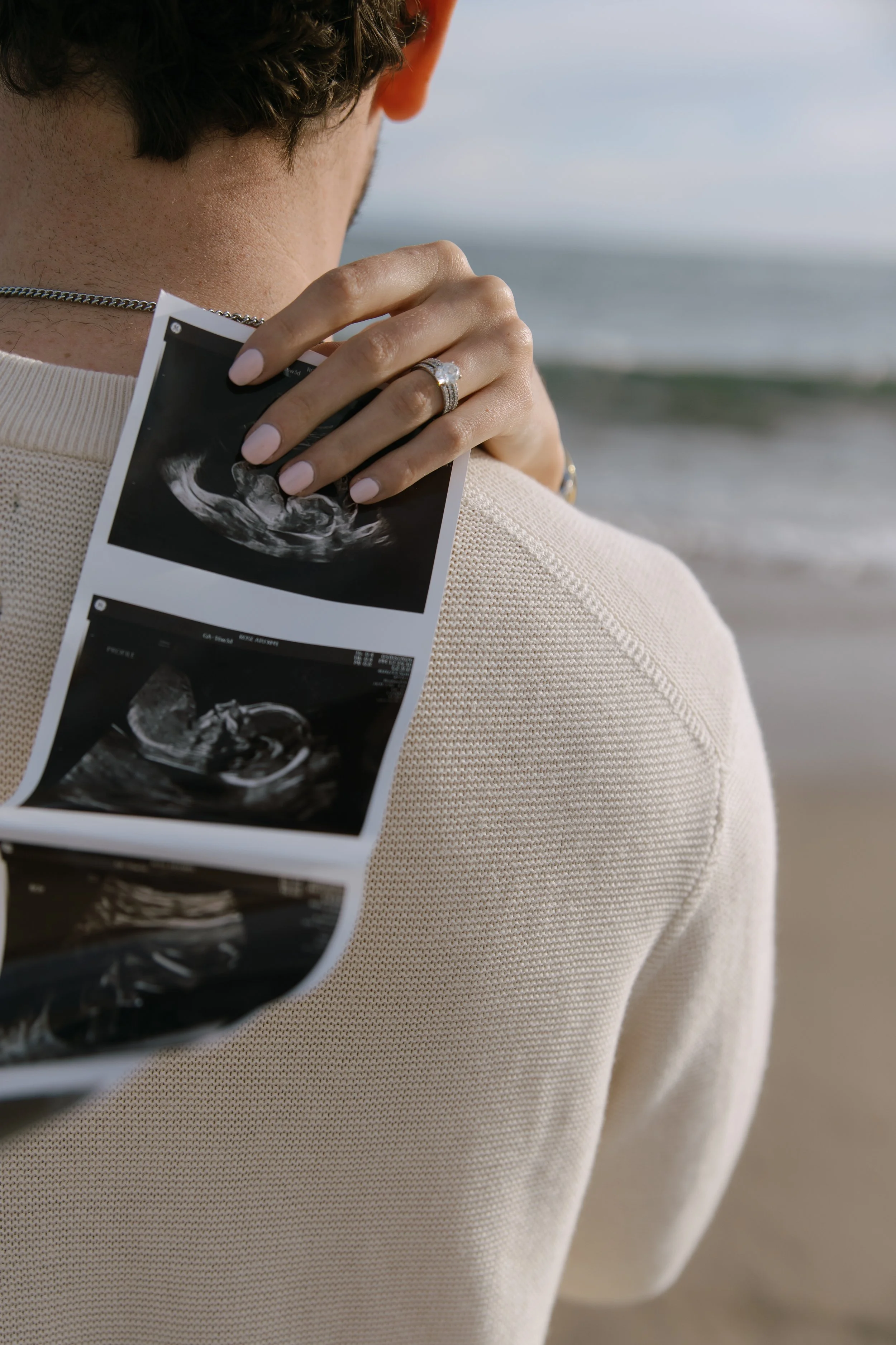 Person holding ultrasound images at the beach, with waves in the background.