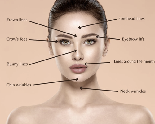 How to Prepare for Your First Botox: 5 Expert Tips for Comfort and ...