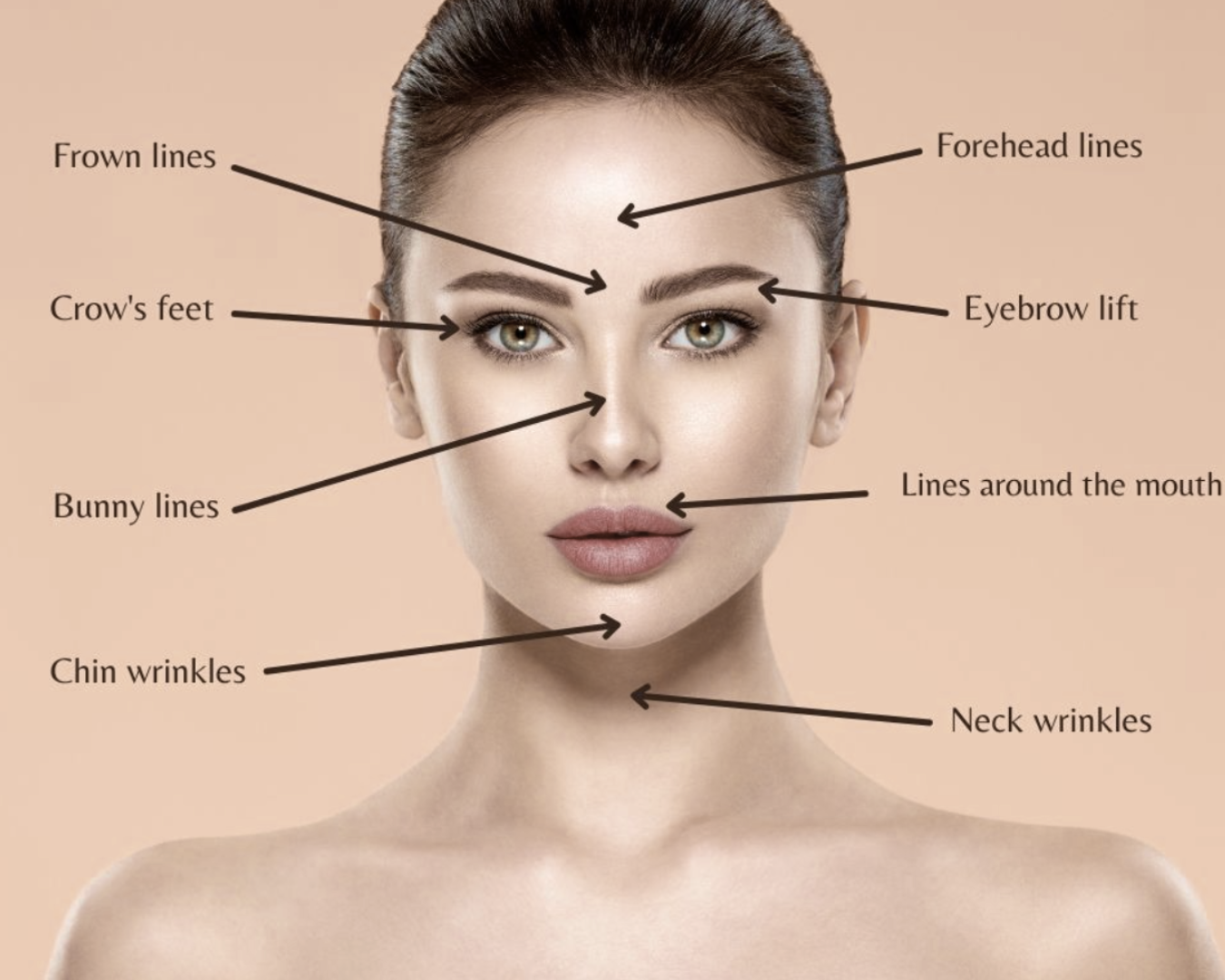 Face diagram showing what Botox and Xeomin can treat