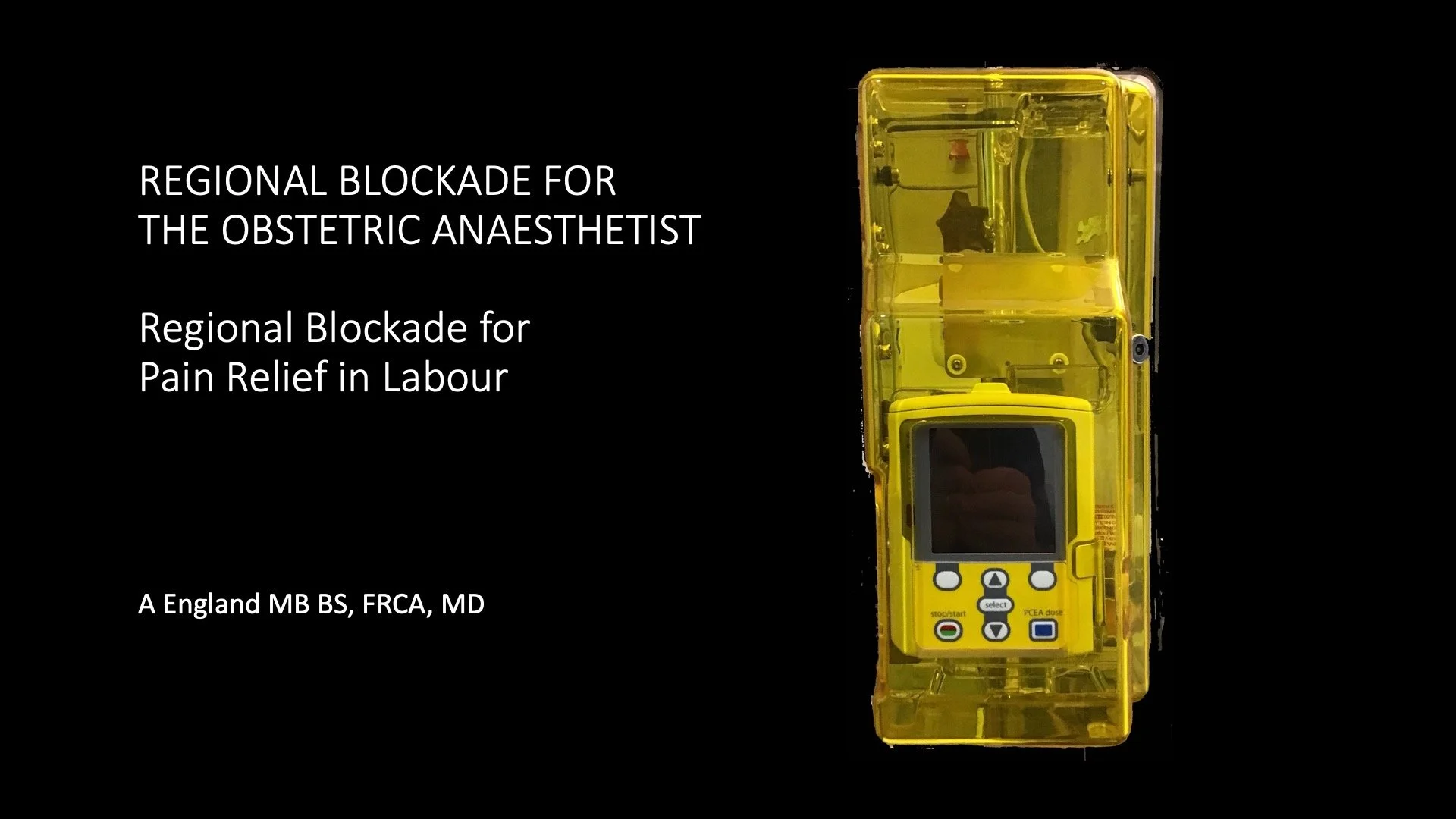 Regional Blockade for Pain Relief in Labour