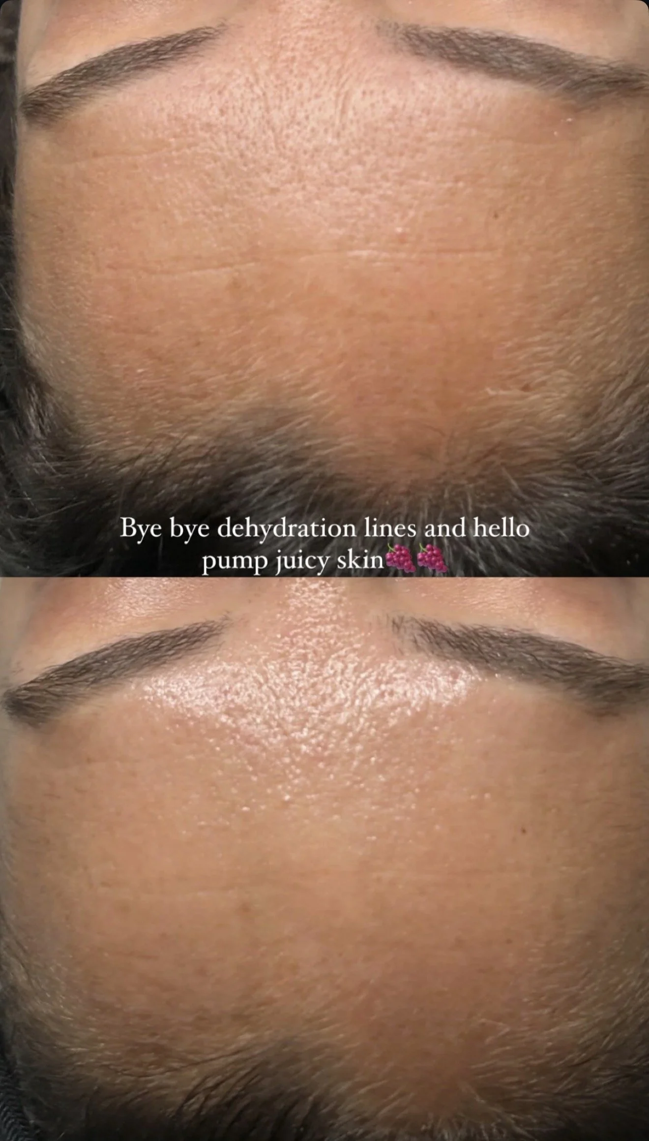 The Real Reason Your Skin Isn’t Improving (And How Custom Facials Fix It)